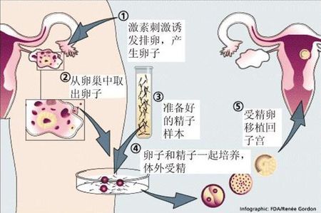 关于景泰生殖